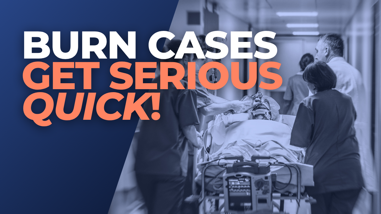 Burn Injury Become a Catastrophic Case in Virginia